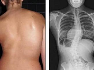 WhatsApp Image 2020 03 04 at 1.21.46 PM